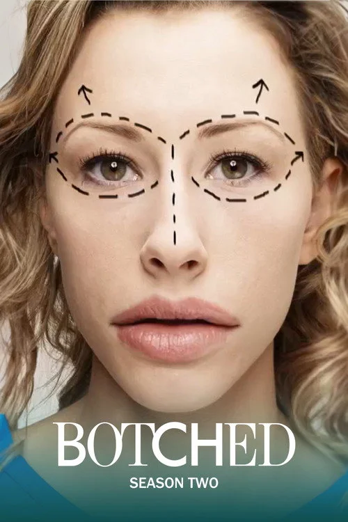 Botched — сезон 2